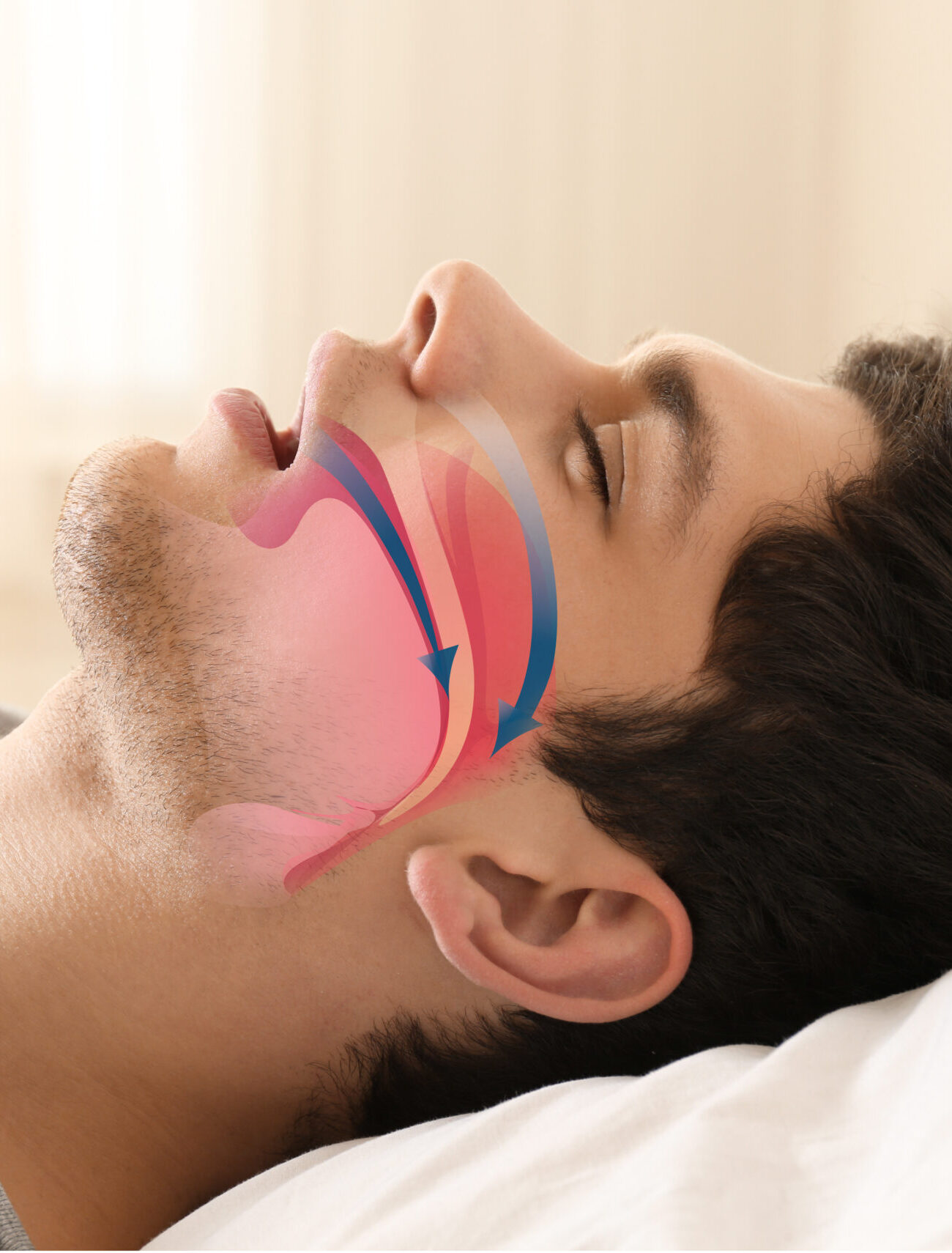 Snore problem concept. Illustration of obstructive sleep apnea