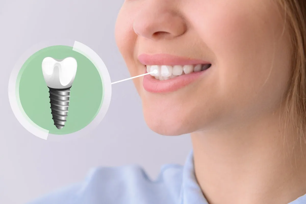 Younag woman with implanted teeth on light background, closeup