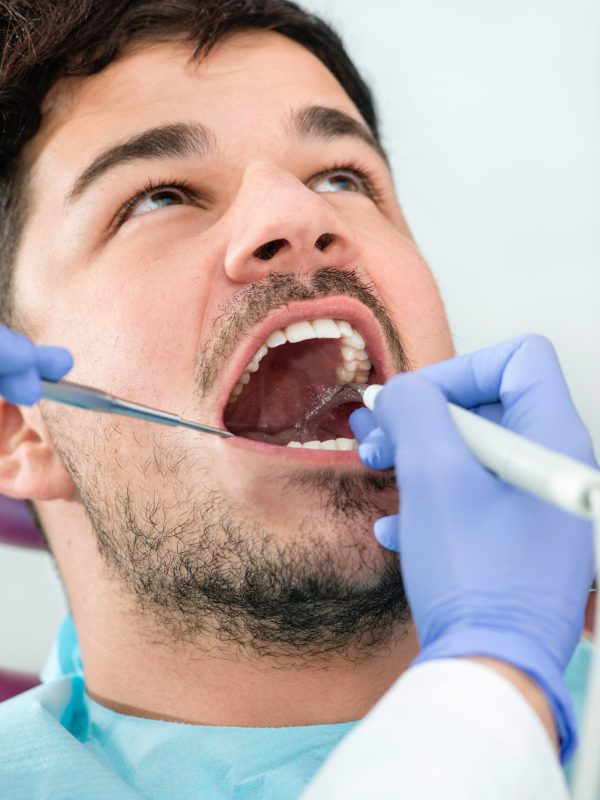 Dental plaque removal at dentist