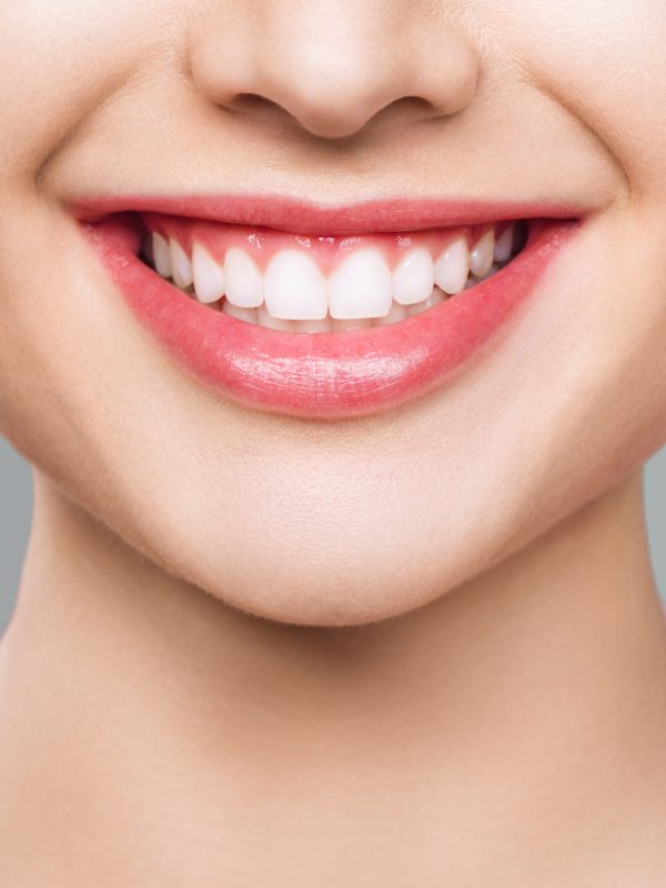 A CloseUp Image Featuring a Beautiful, Smiling Face Showcasing Perfectly White Teeth