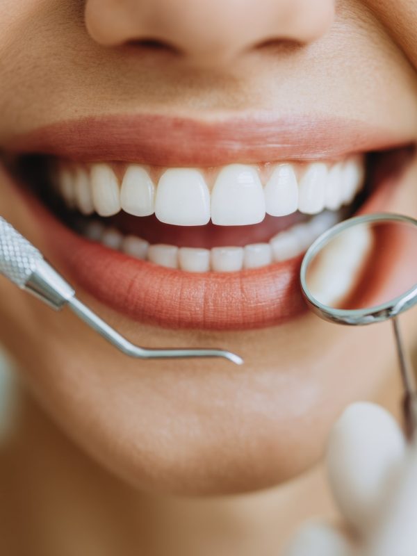 Mouthguard Day Dental Examination Professional Modern Oral Care for Healthy Teeth with Summer Smiles and Back to School Confidence Marketing Content.