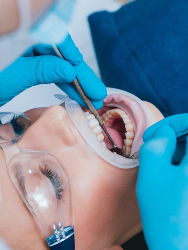 Dental treatment with expander. Modern technology