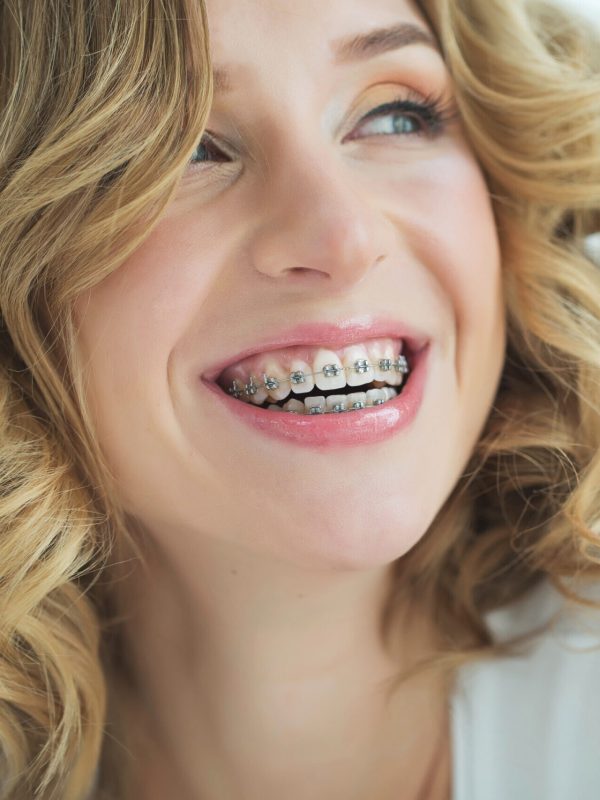Woman in braces