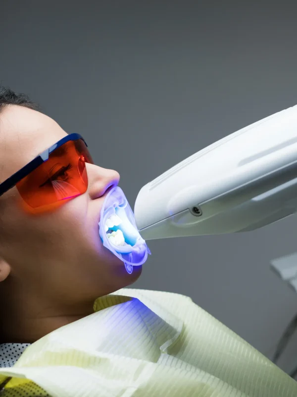Close-up portrait of a female patient at dentist in the clinic. Teeth whitening procedure with ultraviolet light UV lamp.