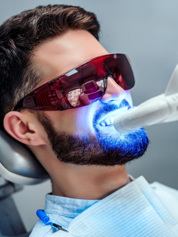 Close up view of man undergoing laser tooth whitening treatment to remove stains and discoloration.
