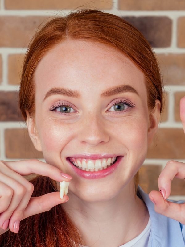 redhaired ginger female with snow-white smile holding white wisdom tooth after surgery removal of a tooth
