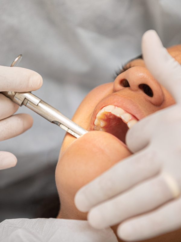 Young woman being seen in a dentist's office. Concept of toothache, wisdom tooth extraction, anesthesia, problems with caries or gums. Oral health care. Dentist day.