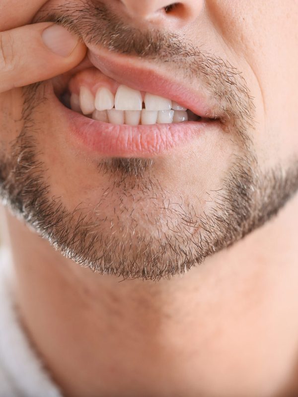 Man suffering from tooth ache in morning, closeup