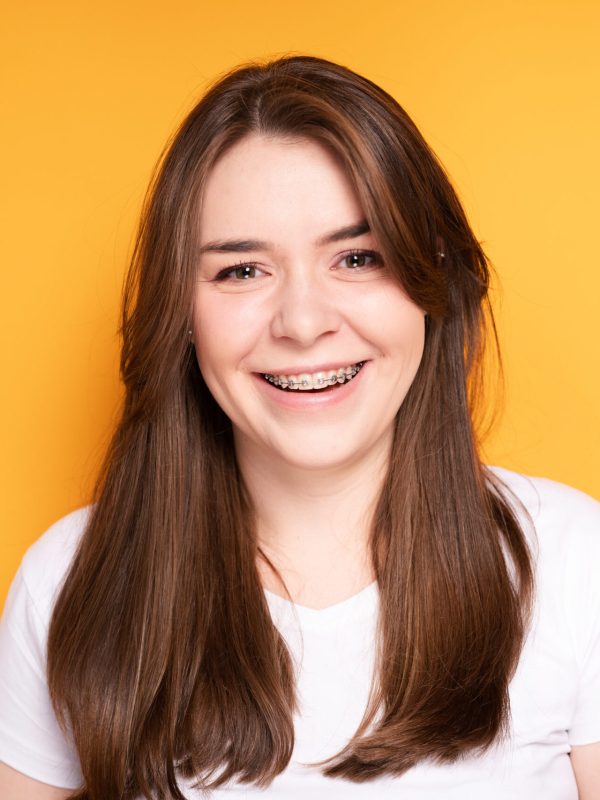 Beautiful brunette with long hair with braces smiling and looking at the camera. High quality photo