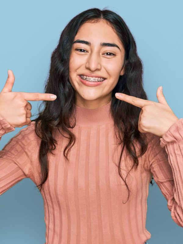 Hispanic teenager girl with dental braces wearing casual clothes smiling cheerful showing and pointing with fingers teeth and mouth. dental health concept.