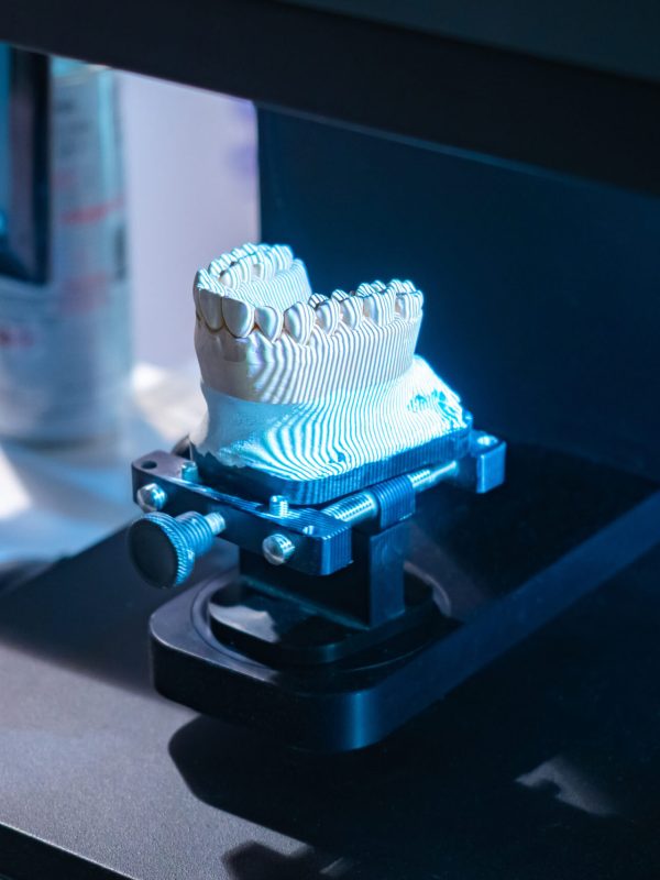 Dental 3D scanner. Close-up of a dental scan with prosthesis. It is designed to create three-dimensional model of prosthesis. Dentist scanner in a dental laboratory. Scanner for dentist technician.