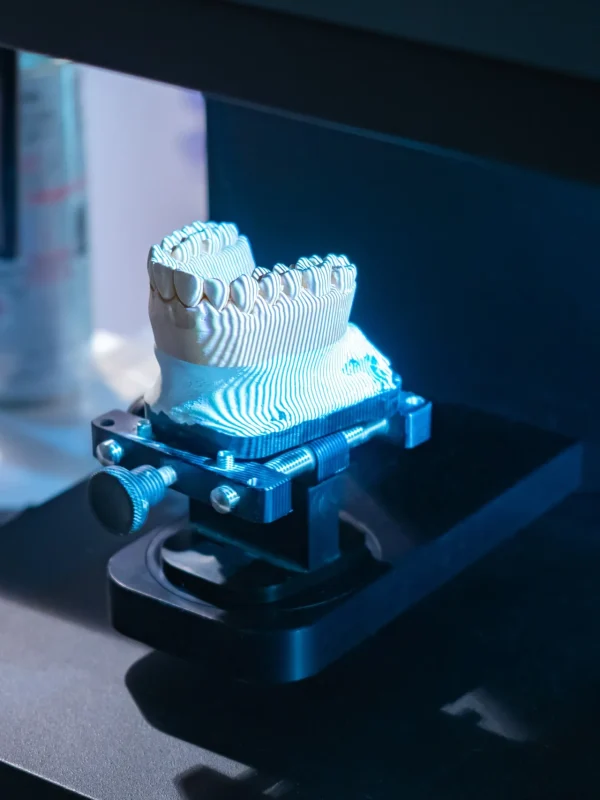Dental 3D scanner. Close-up of a dental scan with prosthesis. It is designed to create three-dimensional model of prosthesis. Dentist scanner in a dental laboratory. Scanner for dentist technician.
