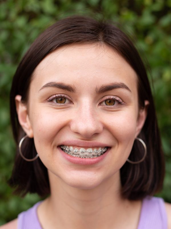 Young girl smiling with metal dental braces on teeth