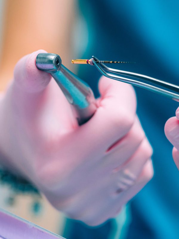 An Endodontist Holding Barbed Broach, Root Canal Treatment in Dental Clinic.