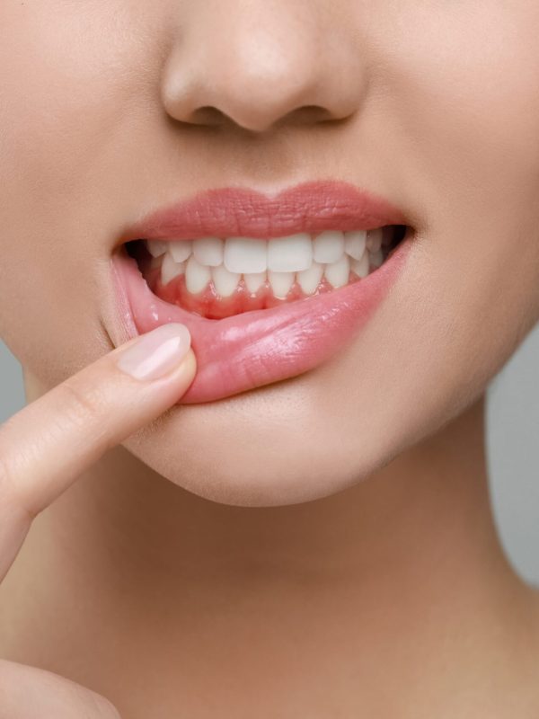 Woman showing inflamed gum on grey background, closeup