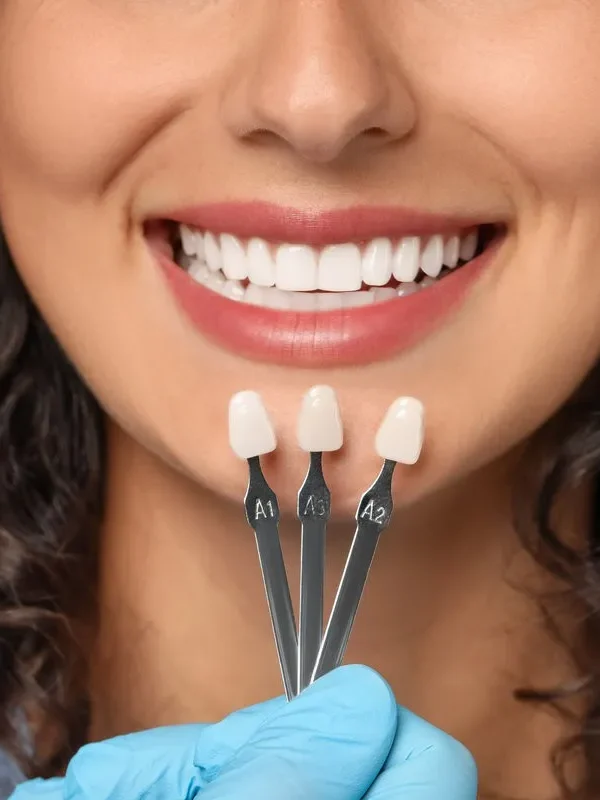 Doctor checking young woman's teeth color, closeup. Dental veneers