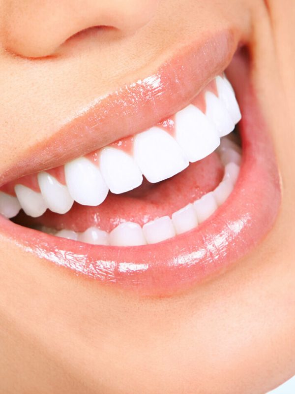 Laughing woman mouth with great teeth over blue background.